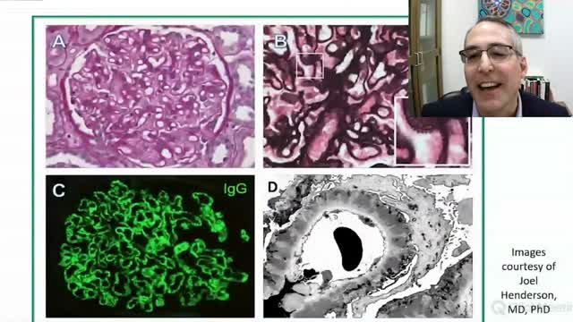 Nephrology Webinar Series Part 1 - EUROIMMUN Academy