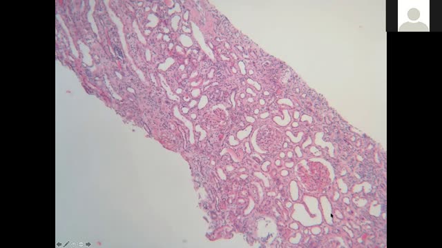 Fellows Conference - Biopsy Practice 4/8/20