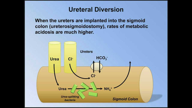 Normal Anion Gap Metabolic Acidosis (ABG Interpretation - Lesson 9)