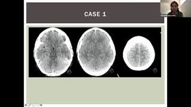 Disorders of Sodium: Hypo- and Hypernatremia with Alexandra Reynolds, MD
