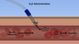 Hypernatremia