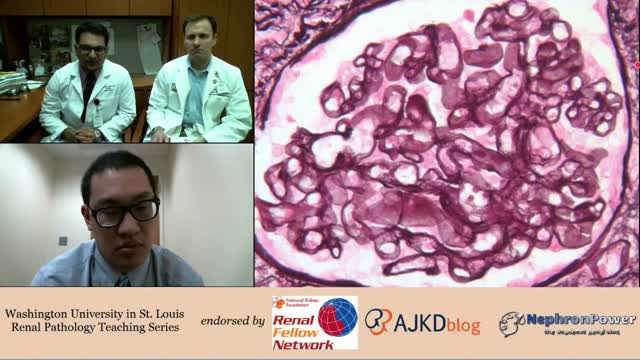 Web Episode #005 - Renal Pathology Teaching Series (Dr. Gaut and Dr. Gupta)