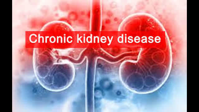 CHRONIC KIDNEY DISEASE  INFOGRAPHICS