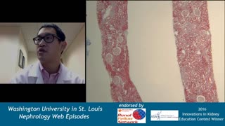 Web Episode #013 - Kidney Pathology 101