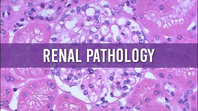 RENAL PATHOLOGY  INFOGRAPHICS