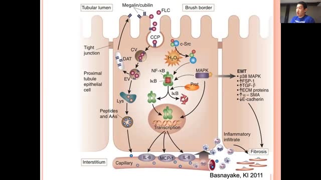 Plasma Cell Dyscrasia and the Kidney - Fellow's Core Curriculum