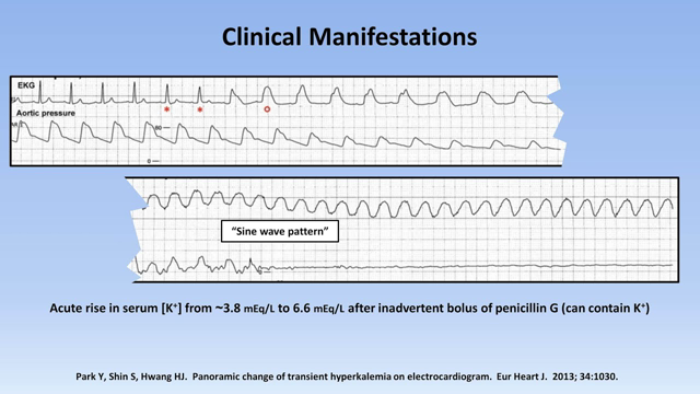 Hyperkalemia