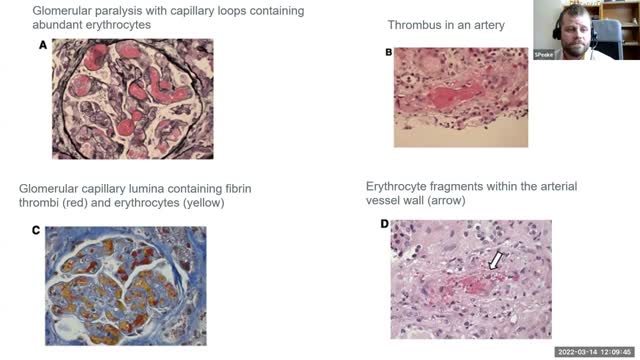 MSBI Department of Medicine Grand Rounds 03/14/2022