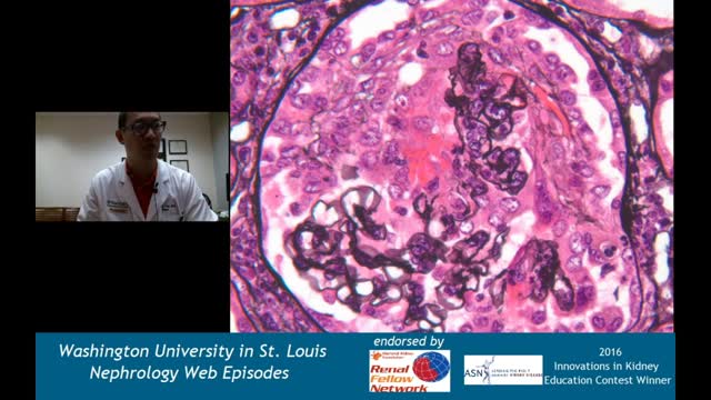 Web Episode #016 - Renal Pathology Series Mystery CPC!