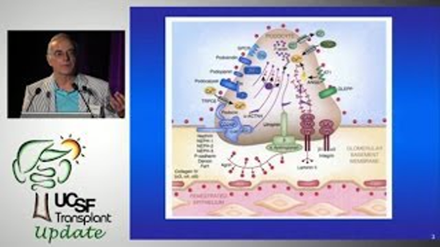 Recurrent FSGS: What’s New? - UCSF Kidney Transplant Program - Update in Transplantation 2013