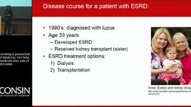 2/22/19: Chronic rejection after kidney transplantation: Is there hope?
