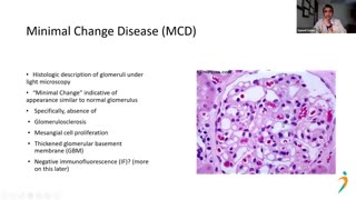 MCD vs. FSGS: Breakdown of Diagnostics and Clinical Course