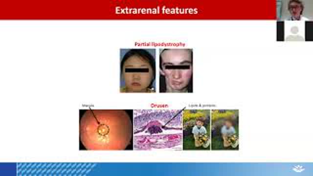 C3G Update: Addressing Innovation and New Learnings