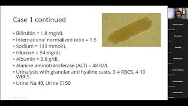 Acute Kidney Injury in Patients with Chronic Liver Disease