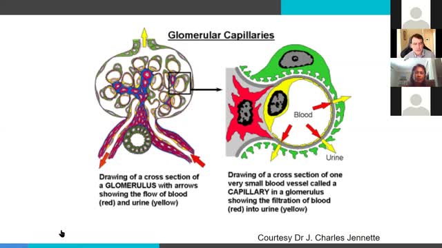 NephCure U: IgA Nephropathy