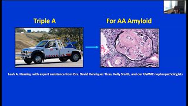 Leah Haseley, MD -  Triple A for AA Amyloid