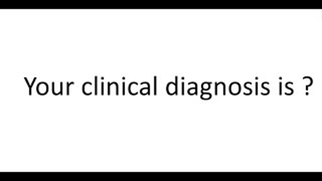 Charles Alpers, MD, Osama Amro, MD, Kelly Smith, MD - Kidney Biopsy Conference